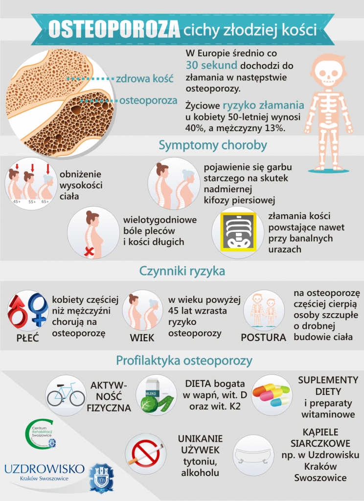 infografika osteoporoza